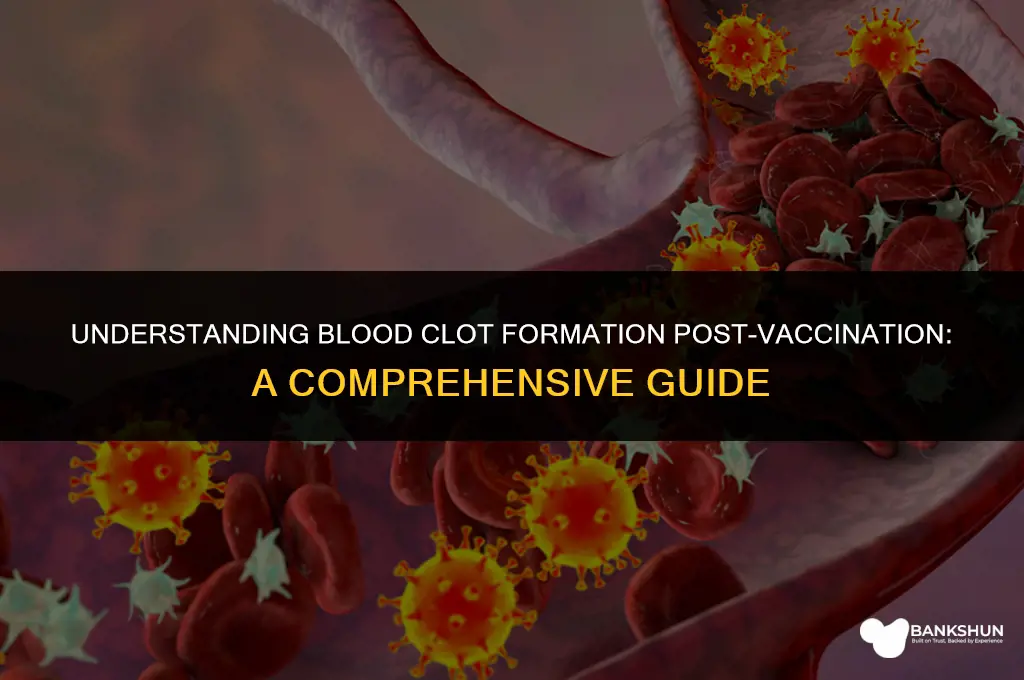 when do blood clots form after vaccination