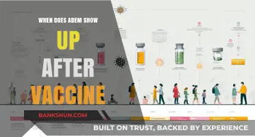 Understanding the Timeline: When Does ADEM Typically Appear Post-Vaccination?