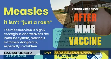 Understanding MMR Vaccine Side Effects: Rash Appearance Timeline