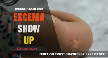 Understanding Vaccine-Related Eczema: Timing and Symptoms