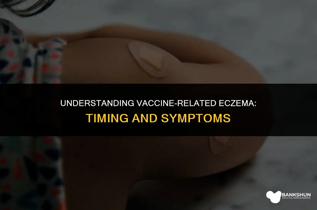 when does vaccine rated excema show up