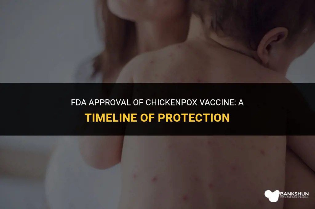 when was chicken pox vaccine fda approved