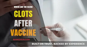Unraveling the Mystery: Blood Clots and COVID-19 Vaccines