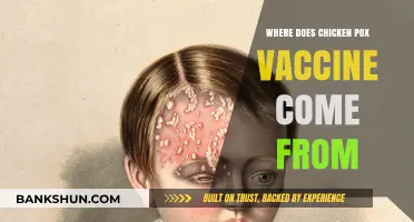 Unveiling the Origins: The Journey of the Chickenpox Vaccine