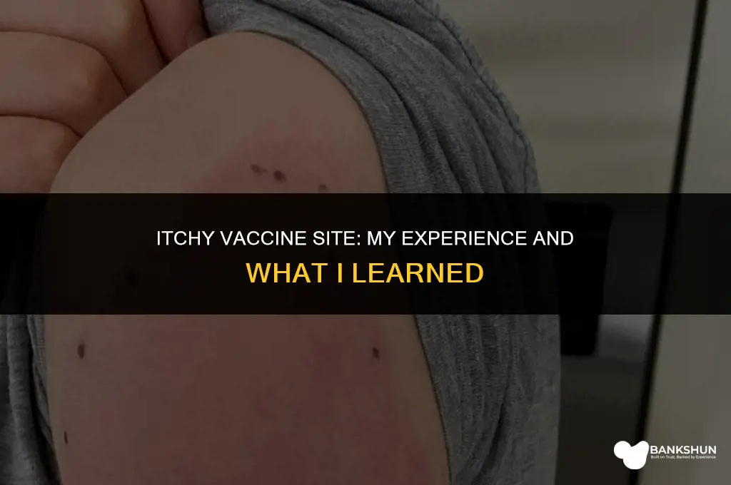 where i got my vaccine is itchy