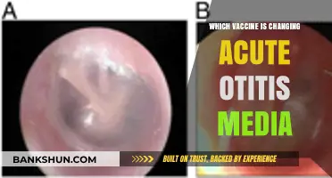 Revolutionizing Ear Health: The Vaccine Transforming Acute Otitis Media Treatment