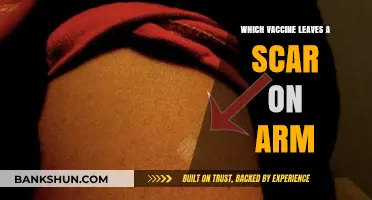 The Truth About Vaccine Scars: What You Need to Know