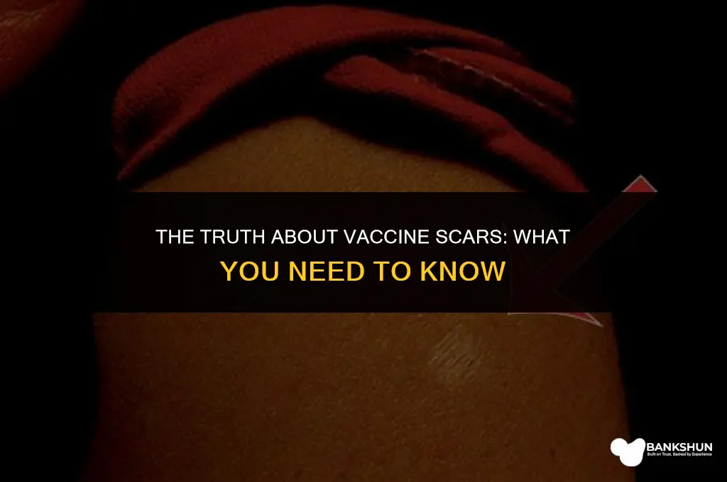 which vaccine leaves a scar on arm