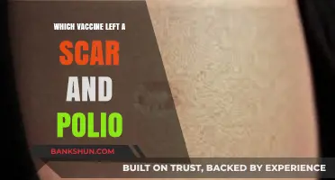 The Legacy of Polio: One Vaccine's Impact and the Scars It Left Behind