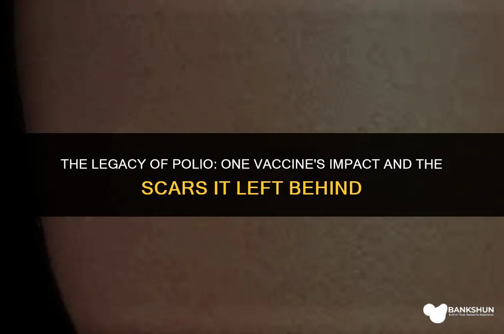 which vaccine left a scar and polio