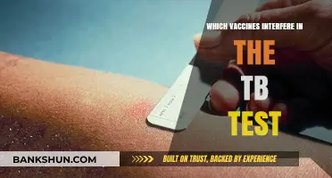 Vaccines That May Affect Your TB Test Results