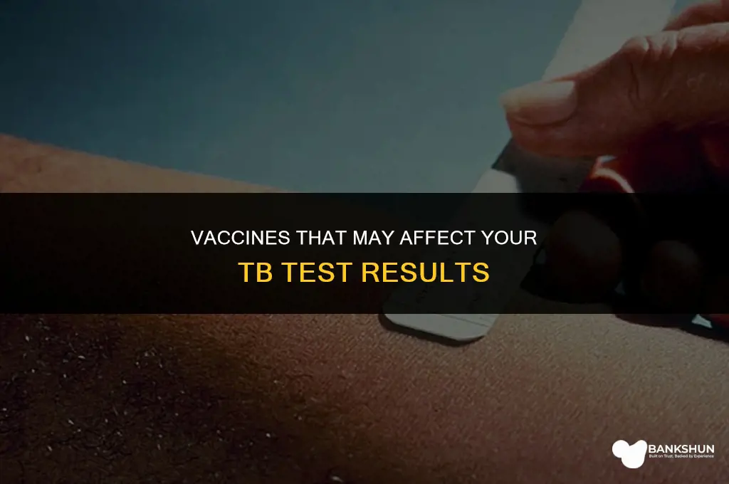 which vaccines interfere in the tb test