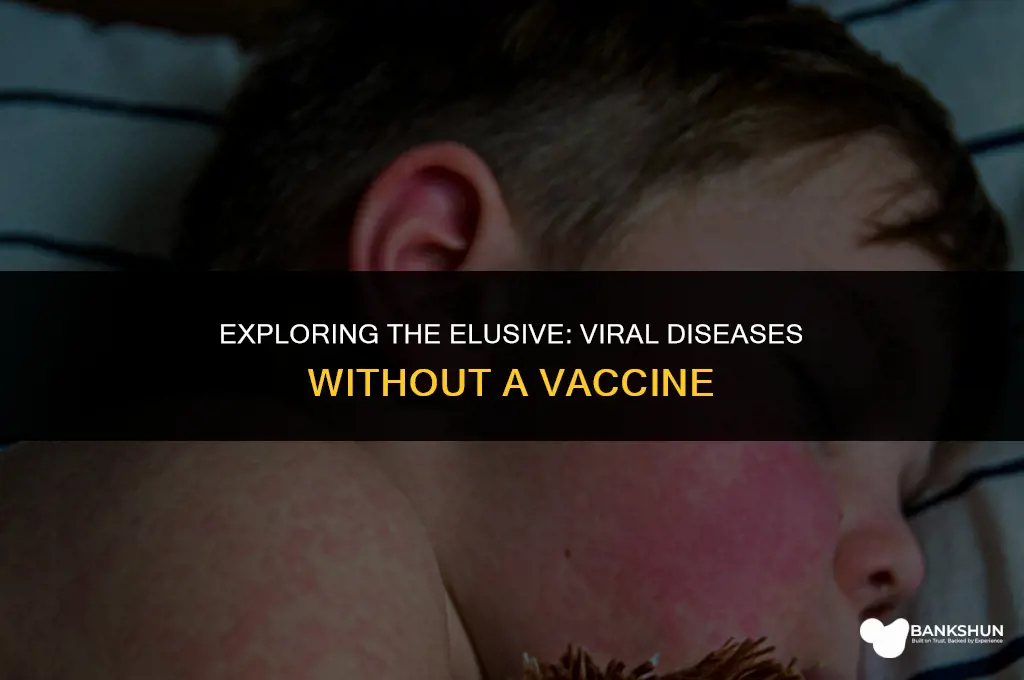 which viral disease has no vaccine available
