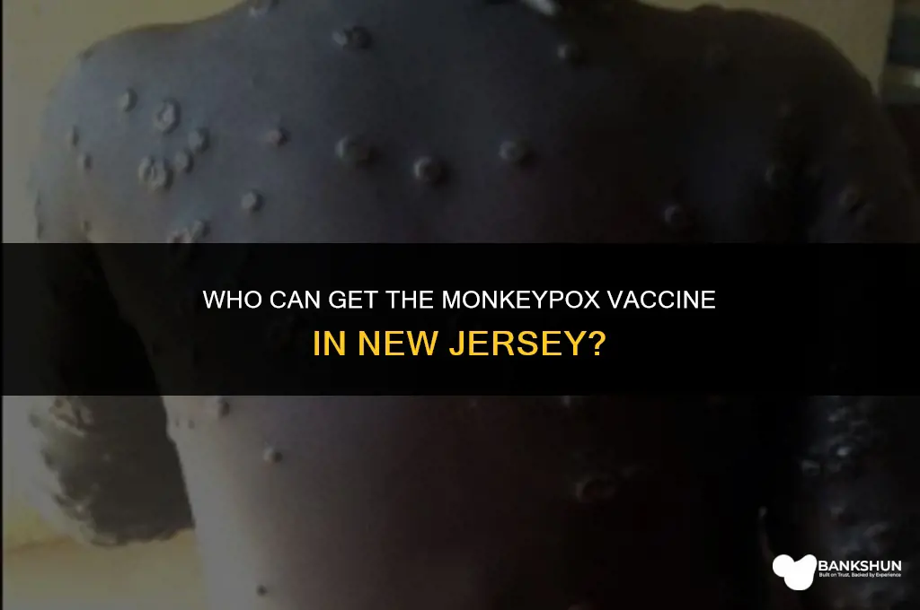 who is eligible for monkeypox vaccine nj