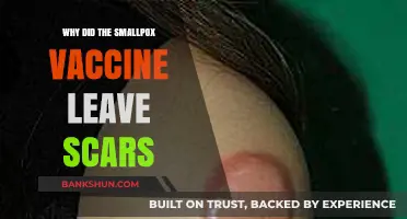 The Pox and the Scars: Unraveling the Smallpox Vaccine's Mark
