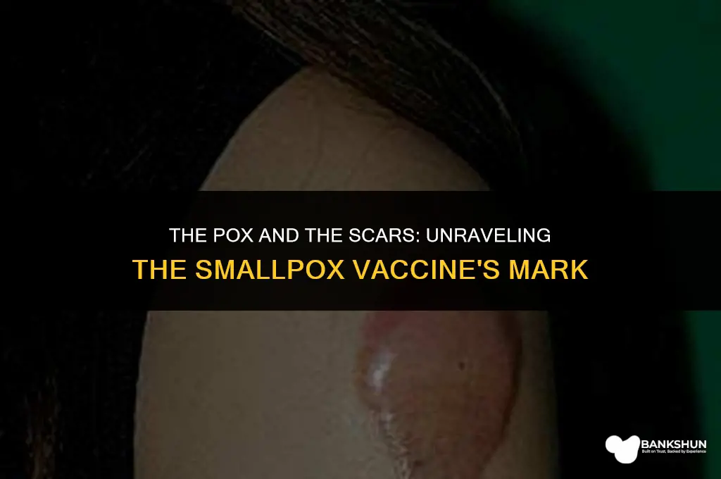 why did the smallpox vaccine leave scars