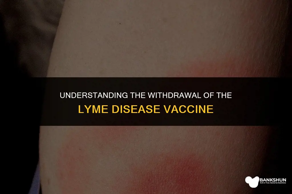 why did they pull the lyme vaccine
