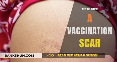 Understanding Vaccination Scars: Causes, Effects, and Prevention Tips