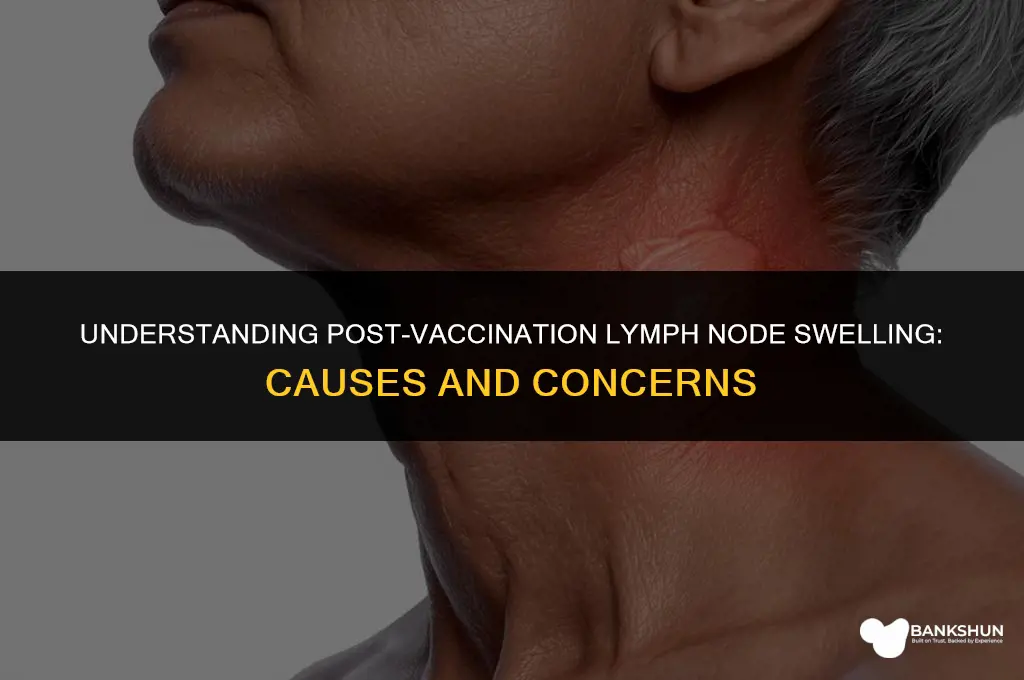 why do lymph nodes swell after vaccination