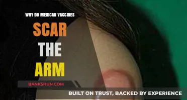 Understanding the Side Effects: Do Mexican Vaccines Cause Scarring?