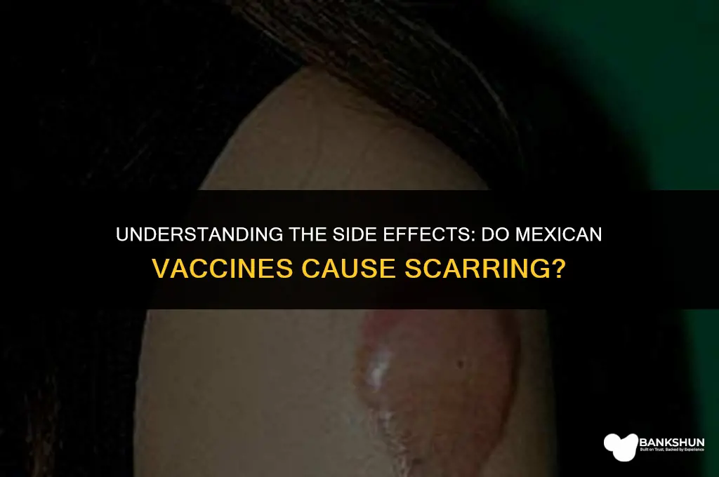 why do mexican vaccines scar the arm